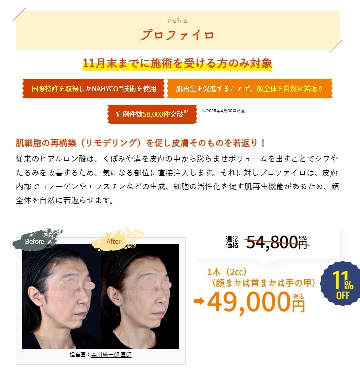 11月のキャンペーン