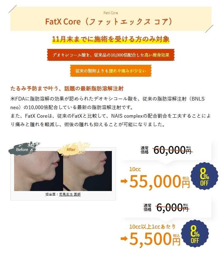 11月のキャンペーン