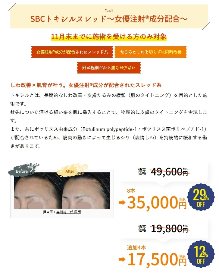 11月のキャンペーン