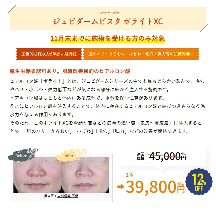 11月のキャンペーン