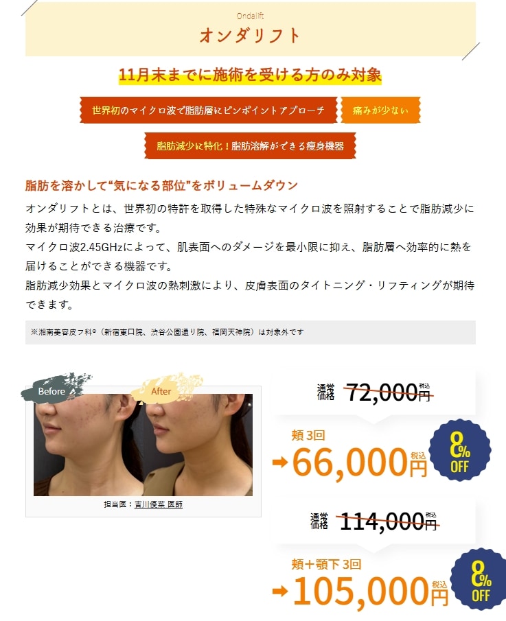 11月のキャンペーン