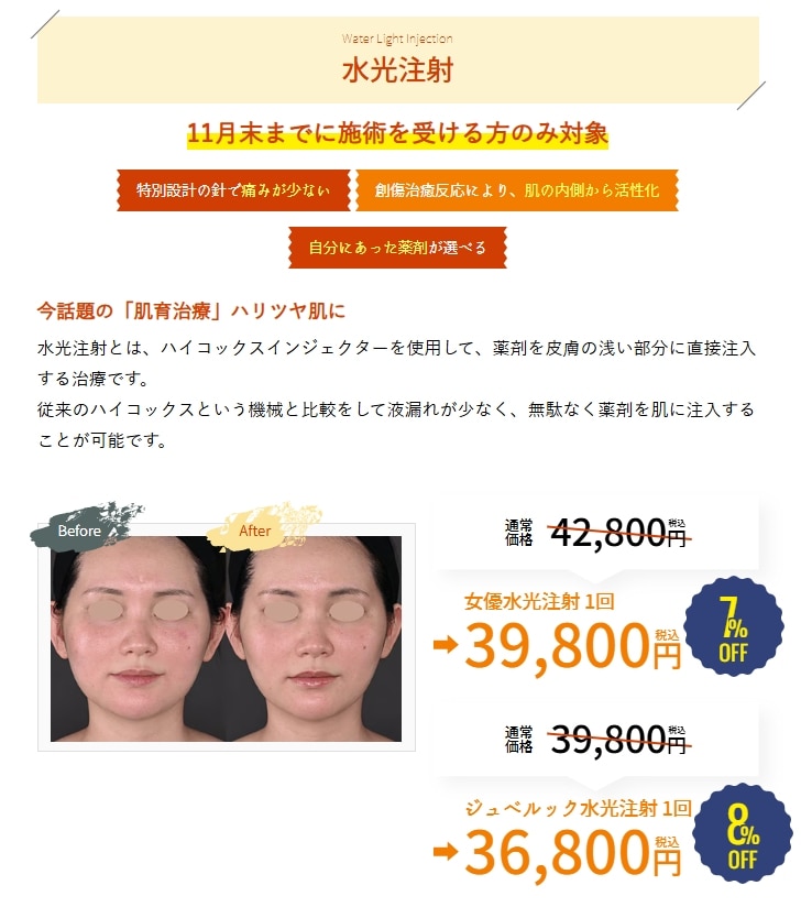 11月のキャンペーン