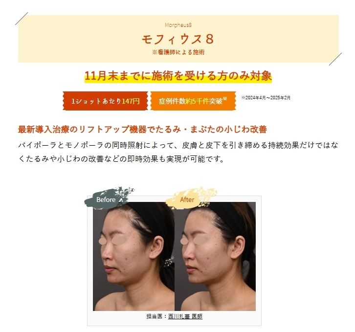 11月のキャンペーンモフィウス1