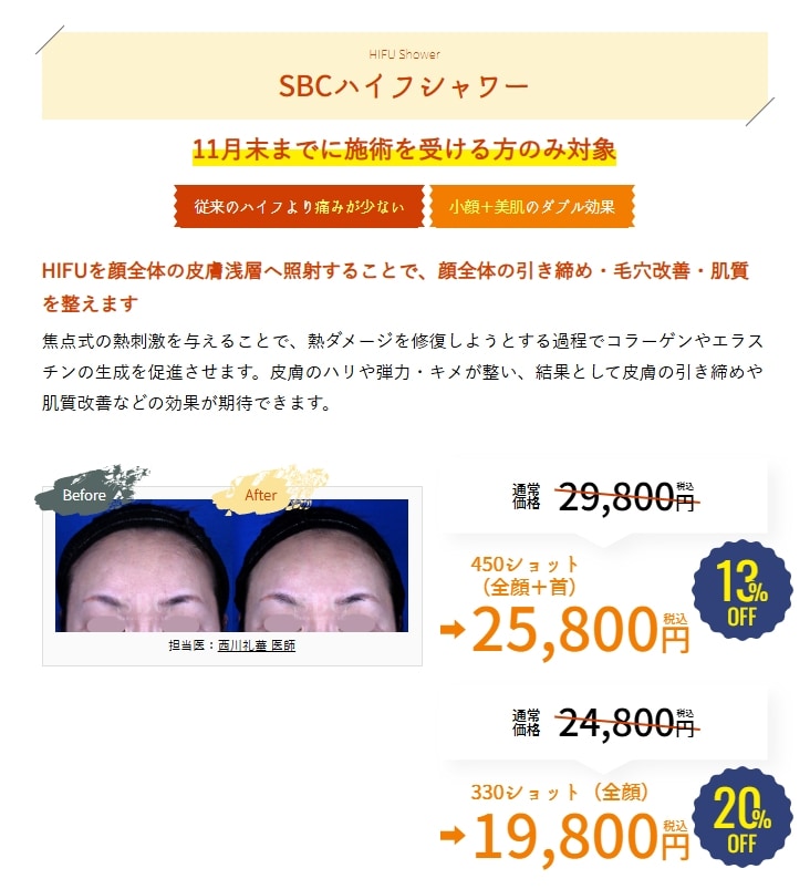 11月のキャンペーン