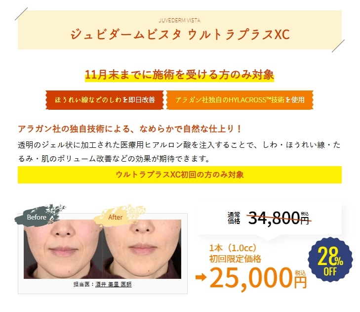 11月のキャンペーン