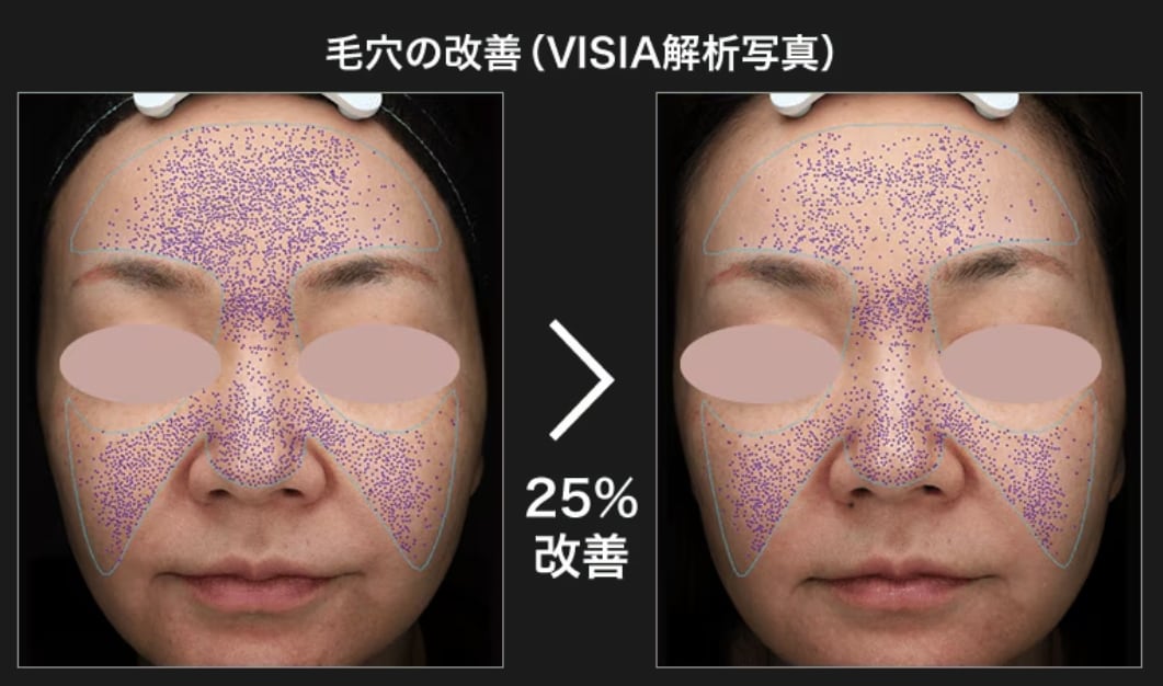 ゲリラキャンペーン