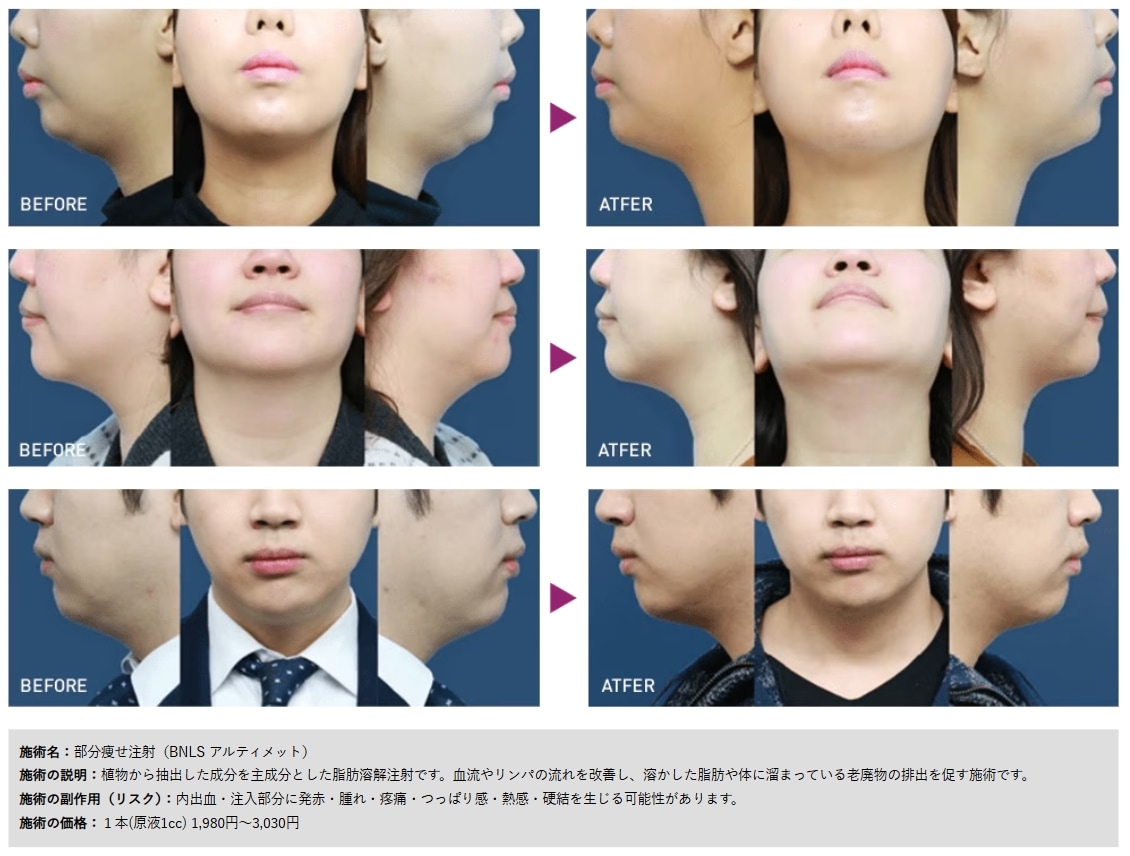 ゲリラキャンペーン