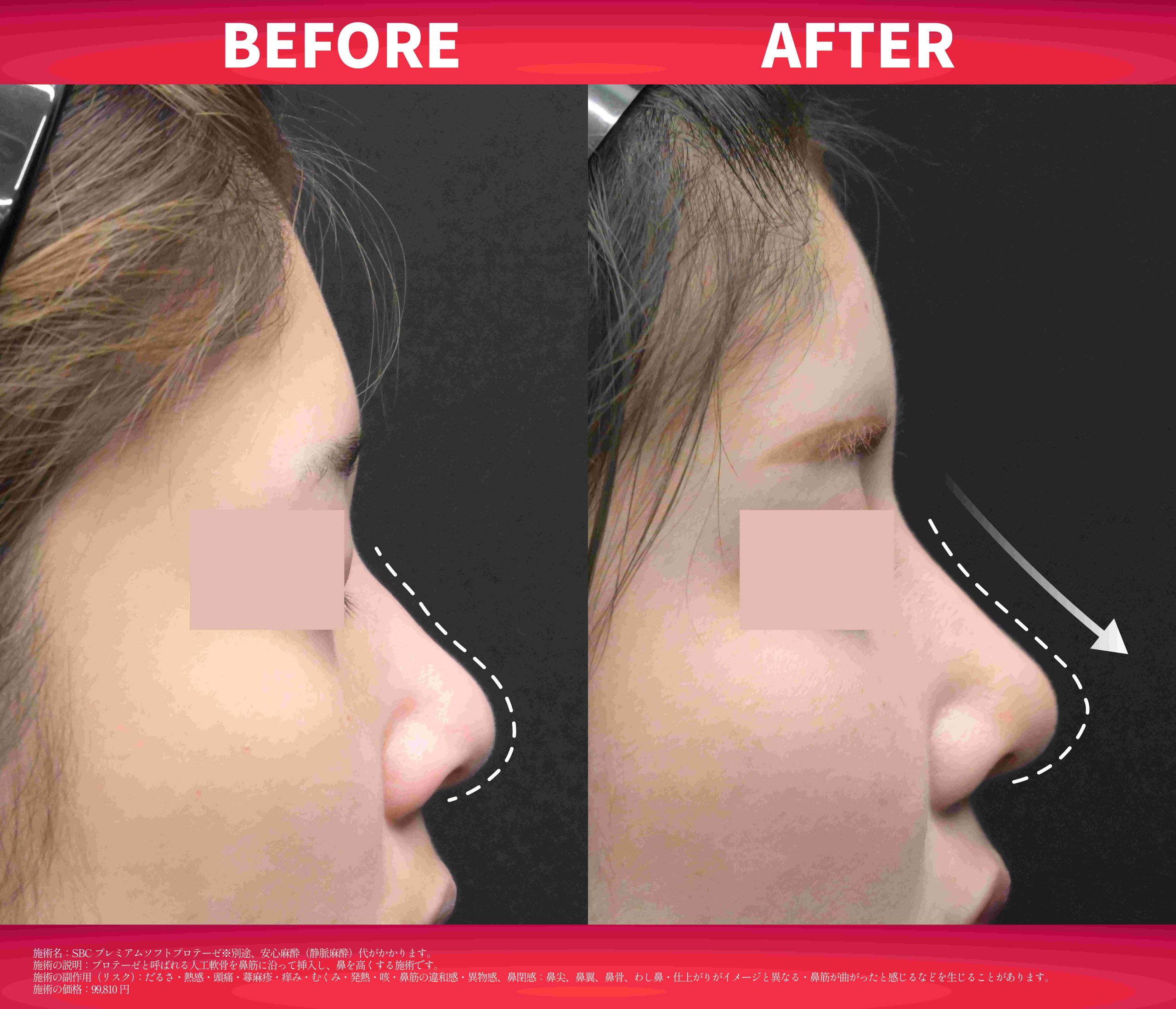 11月のキャンペーン