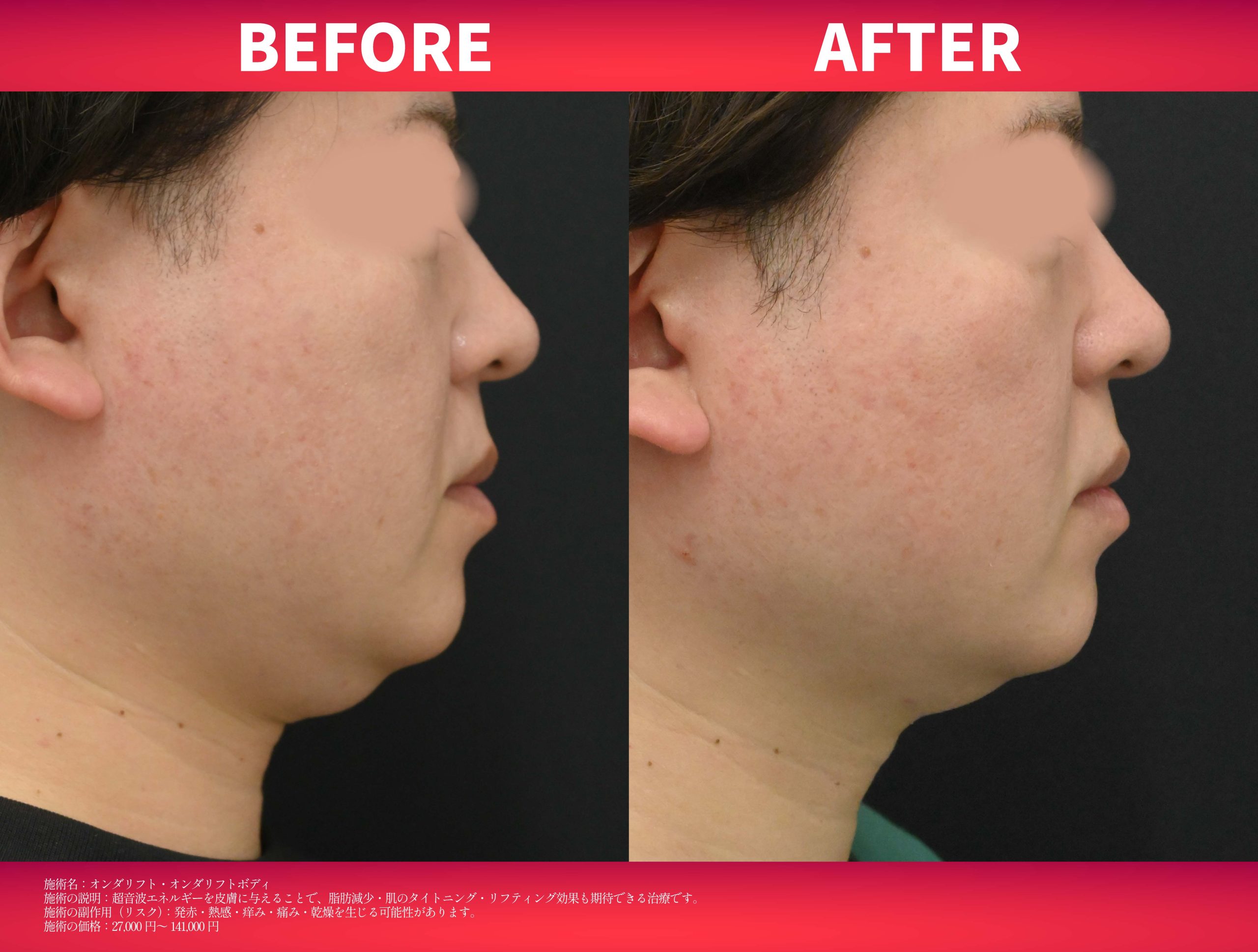 11月のキャンペーン