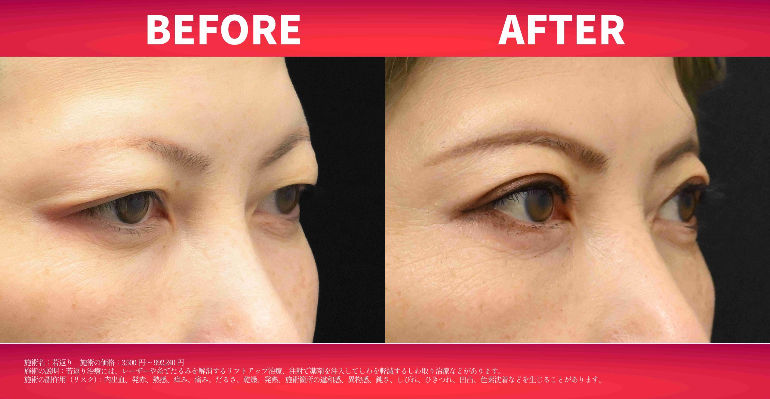 11月のキャンペーン