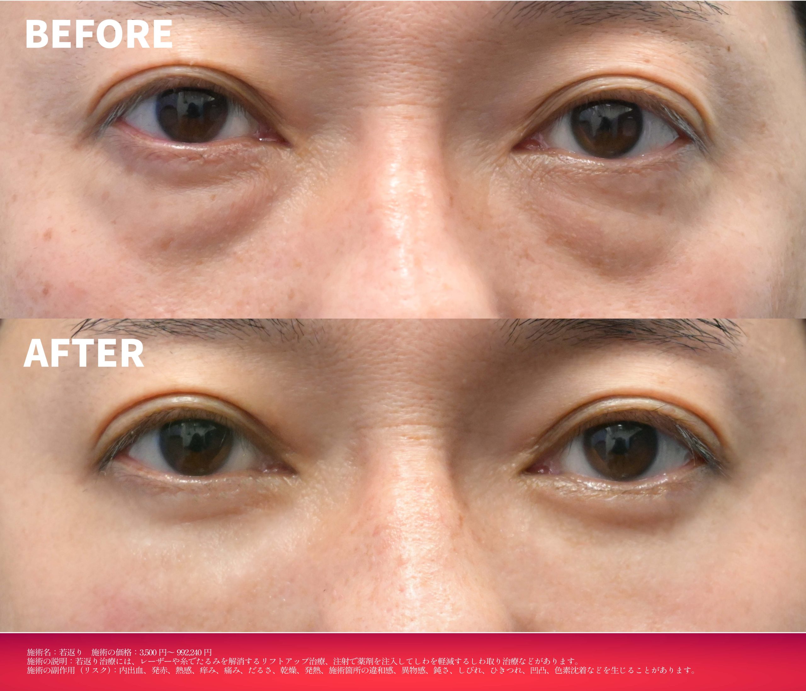 11月のキャンペーン