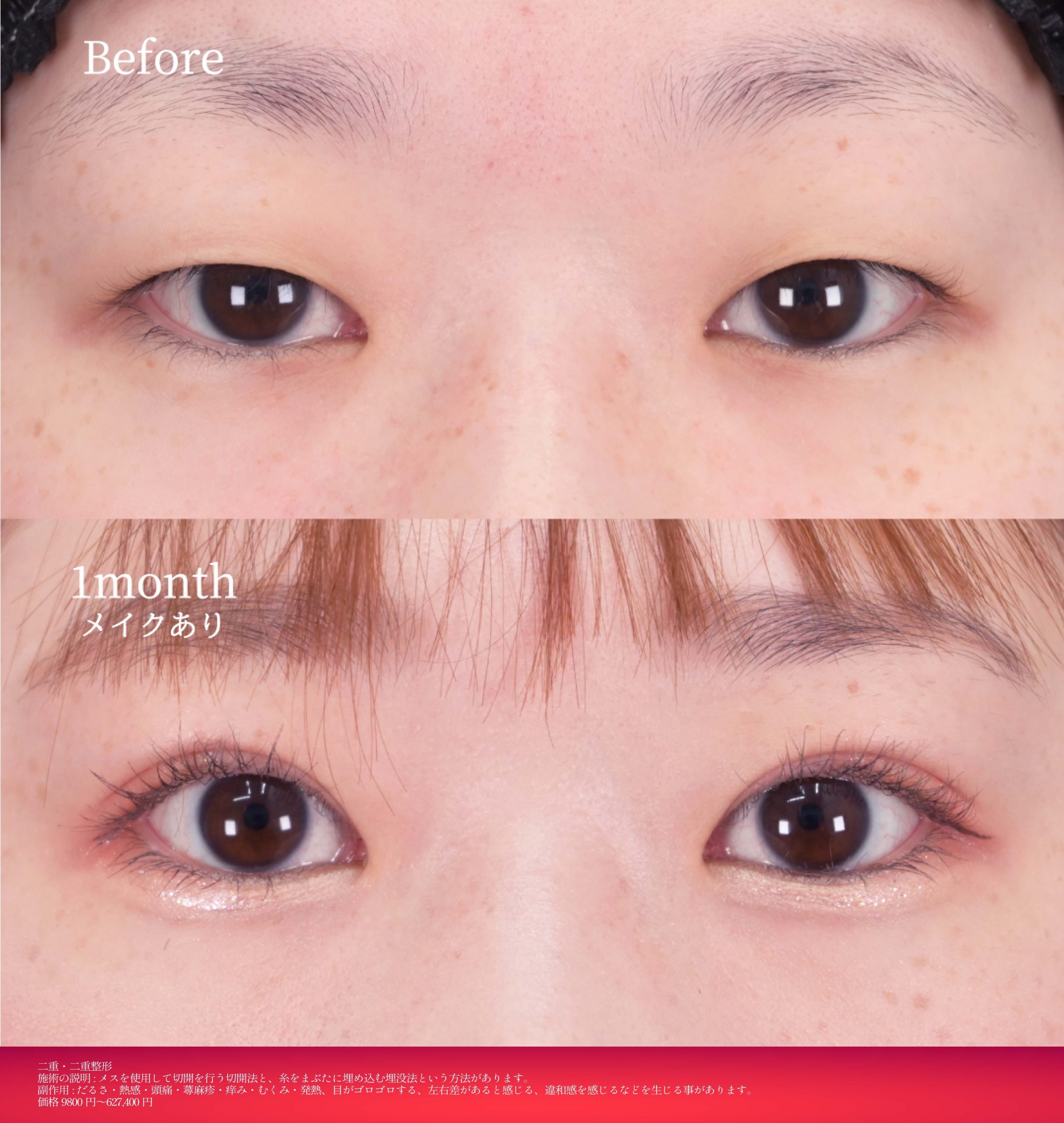 11月のキャンペーン