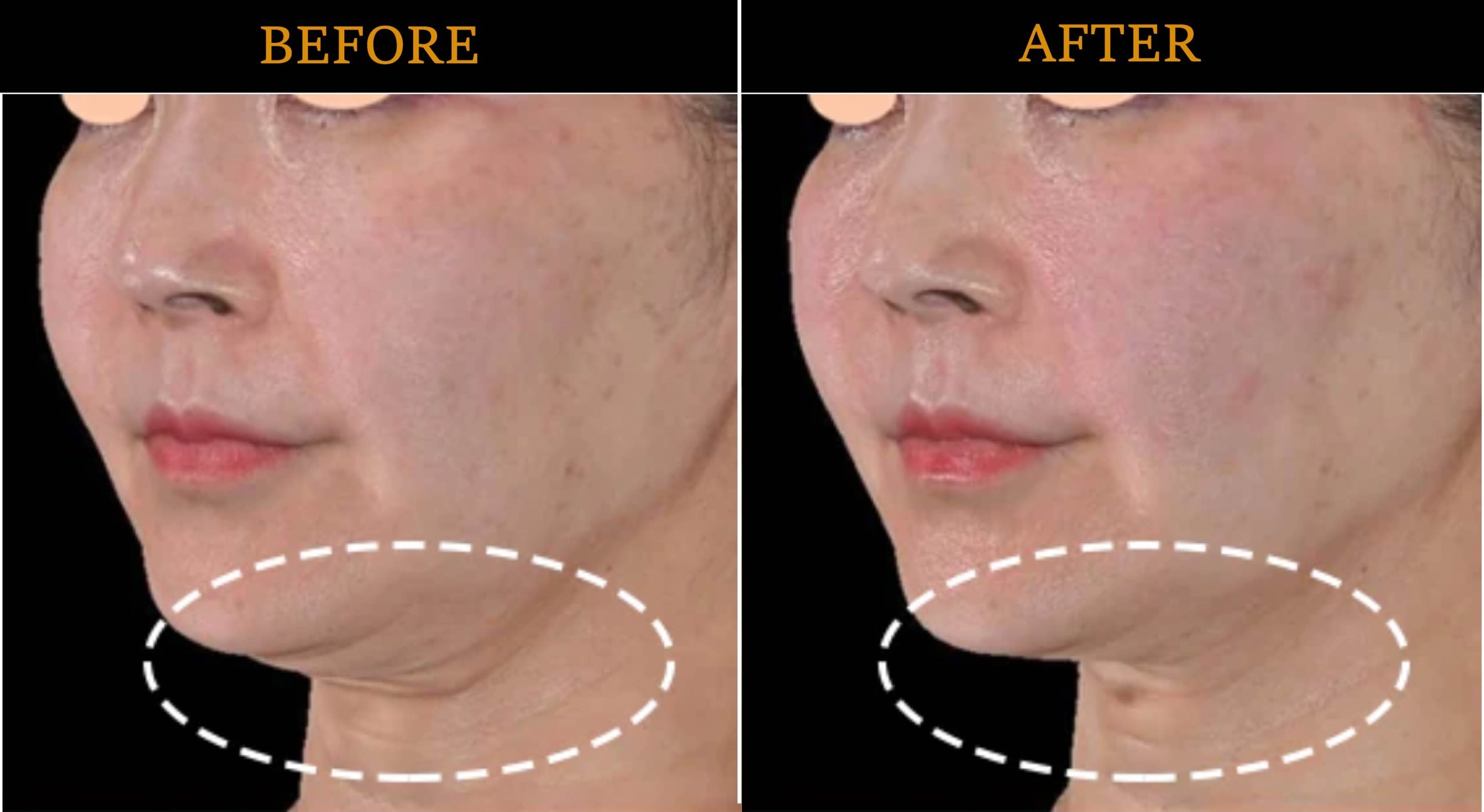 ブラックフライデー