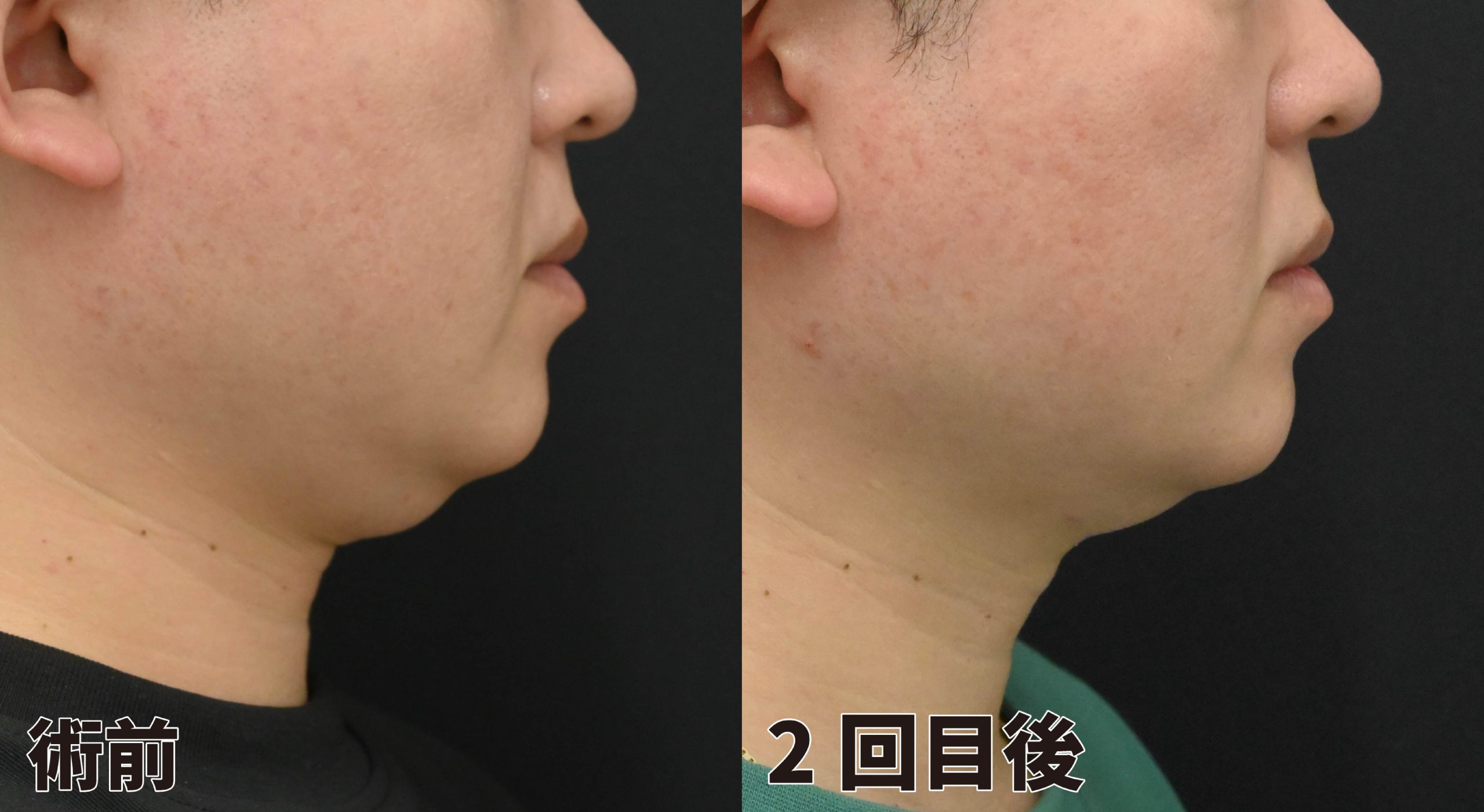 ブラックフライデー