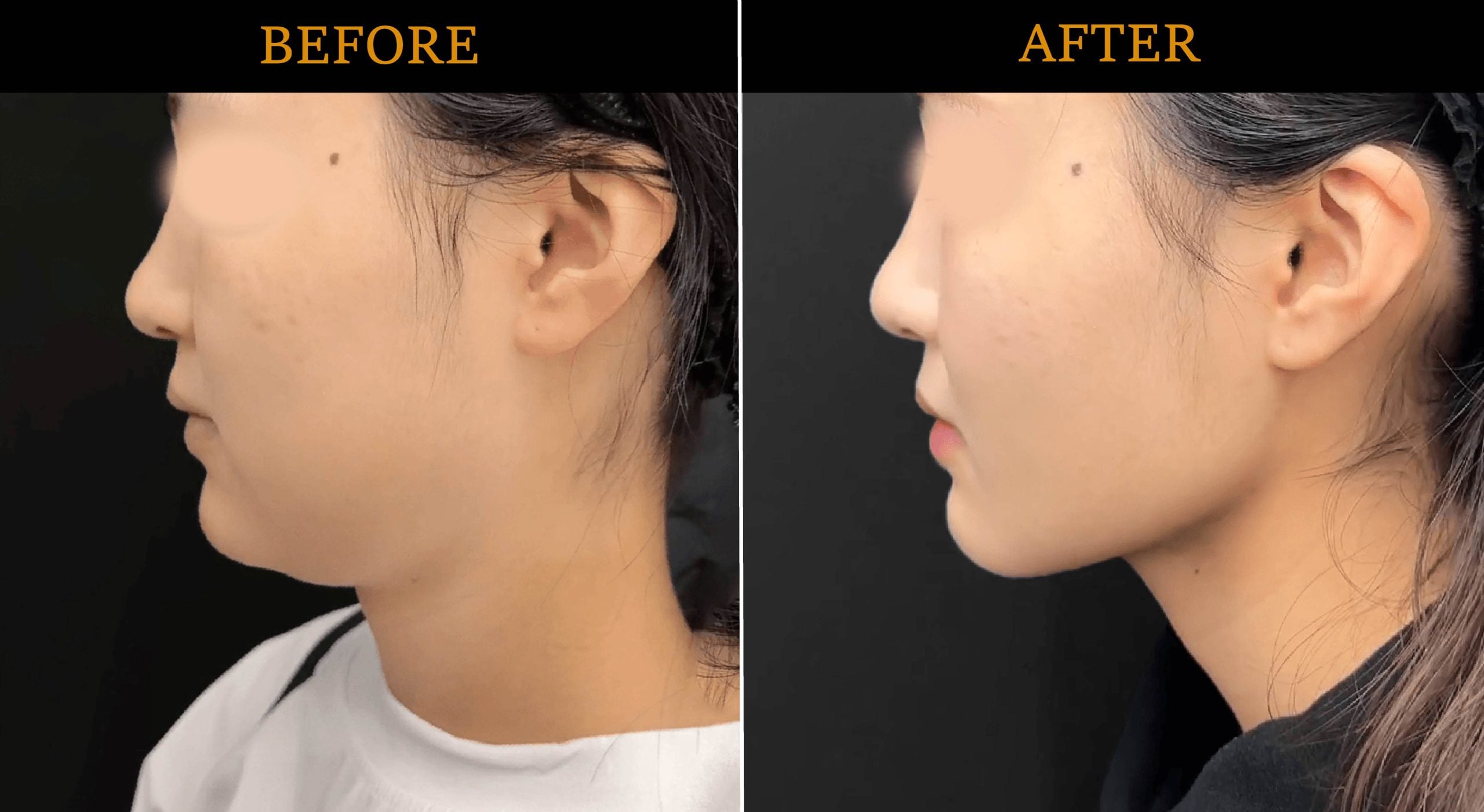 ブラックフライデー