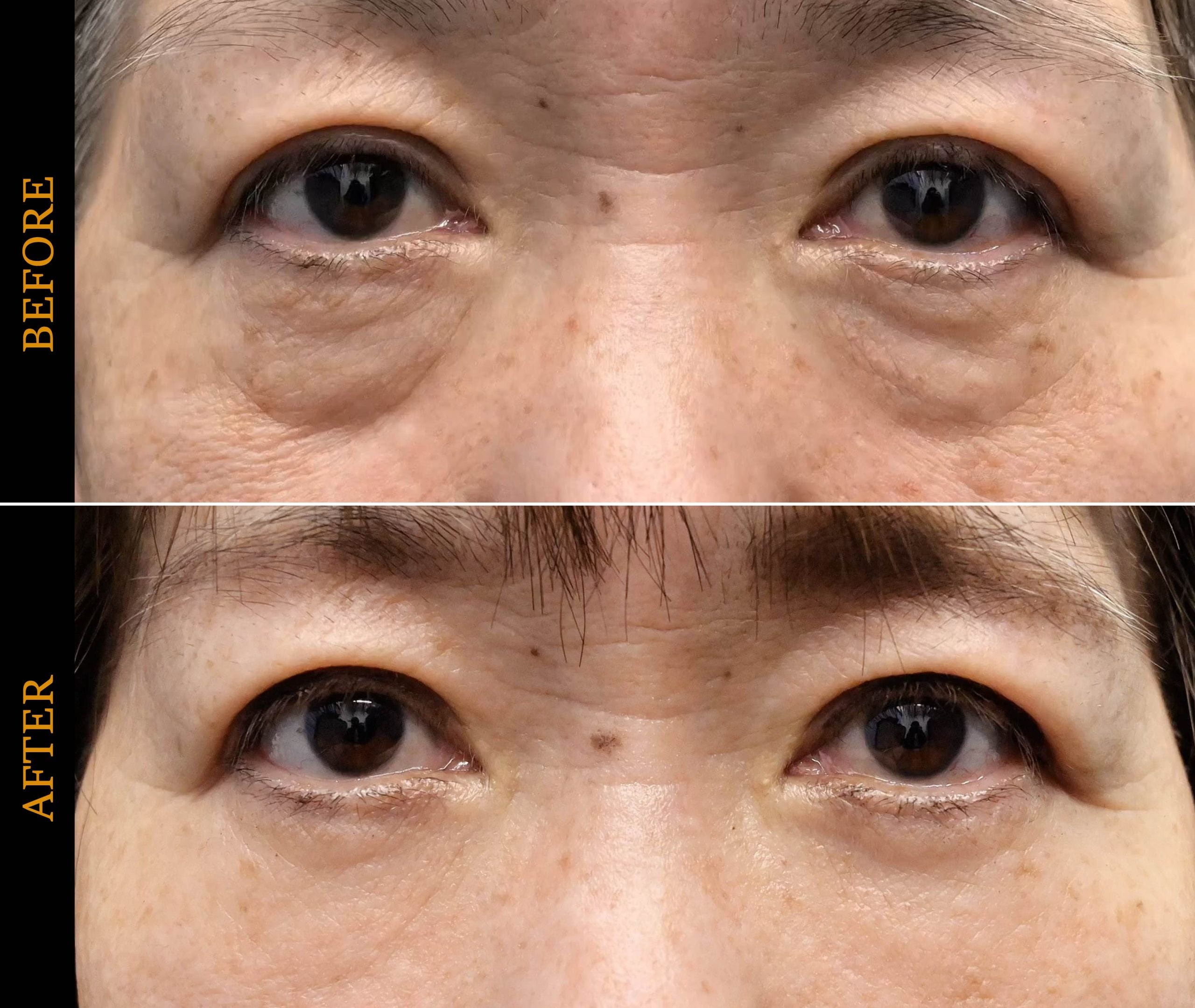 ブラックフライデー