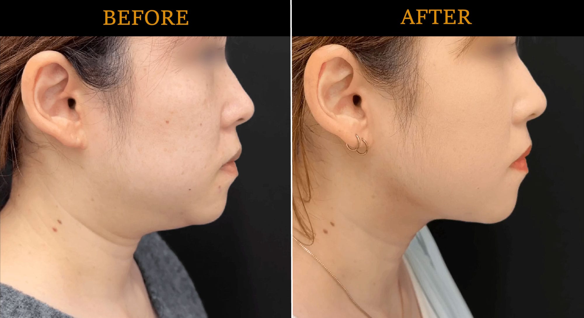 ブラックフライデー