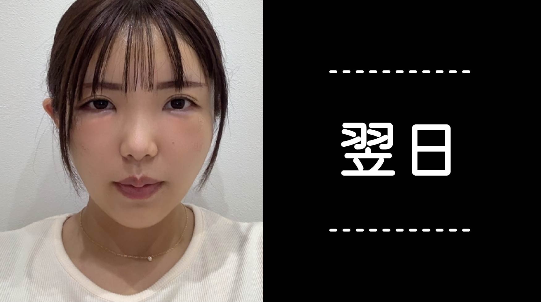 クマ取り30日間レポ