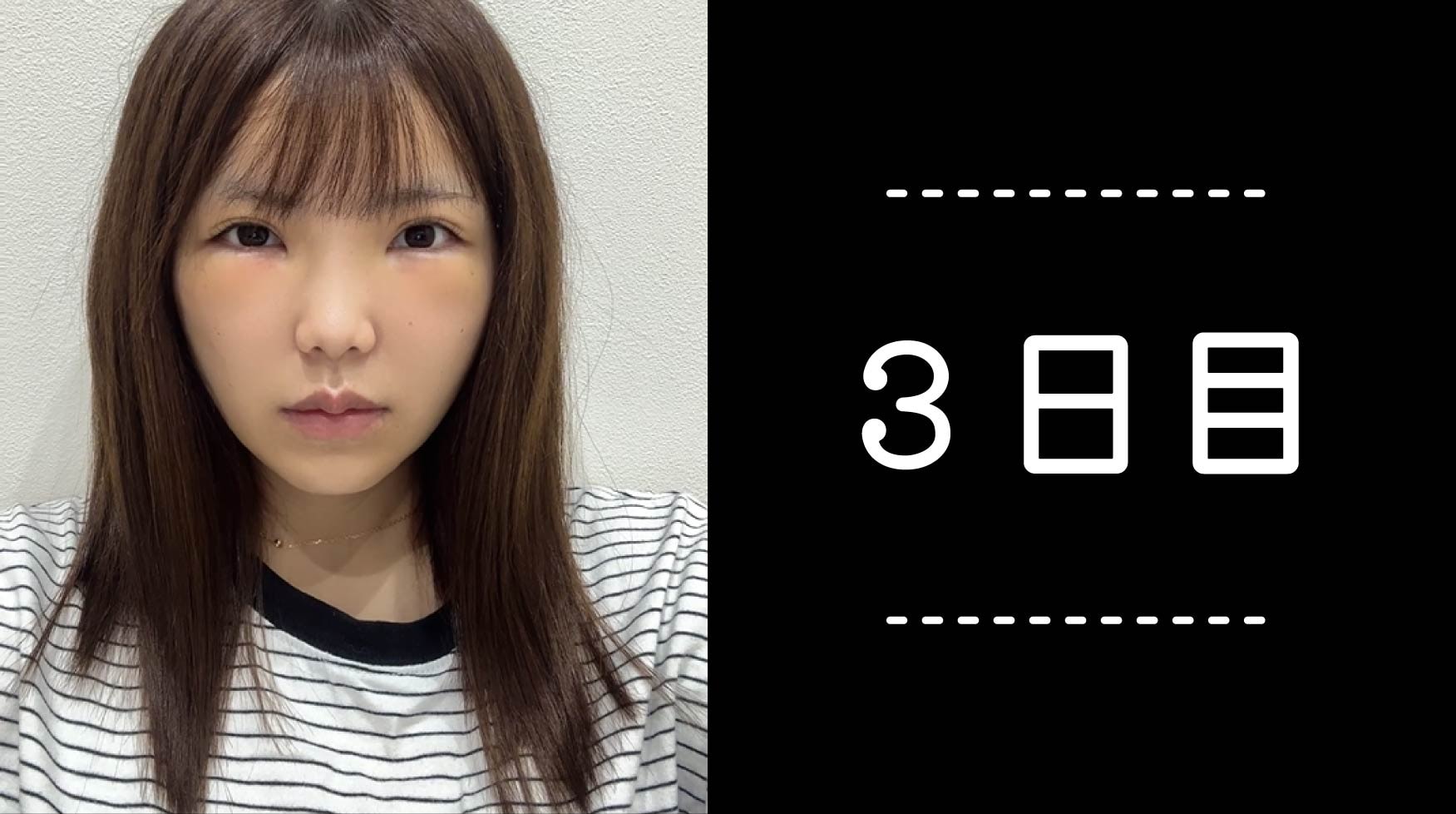 クマ取り30日間レポ