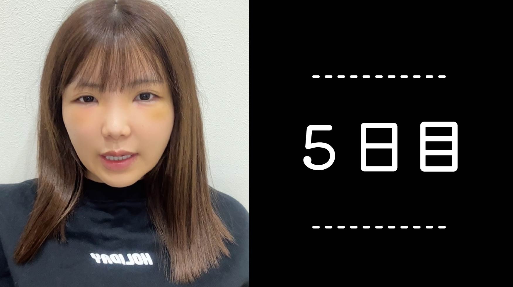 クマ取り30日間レポ