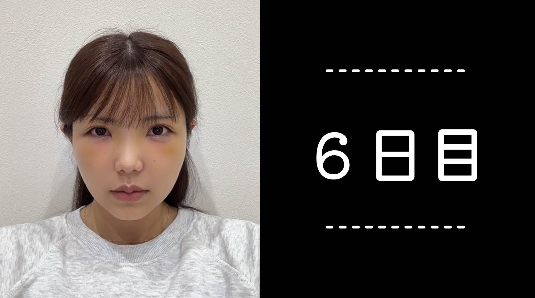 クマ取り30日間レポ