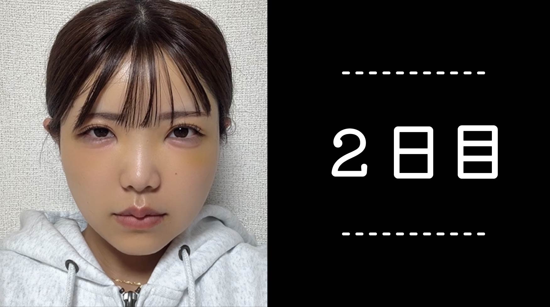 クマ取り30日間レポ