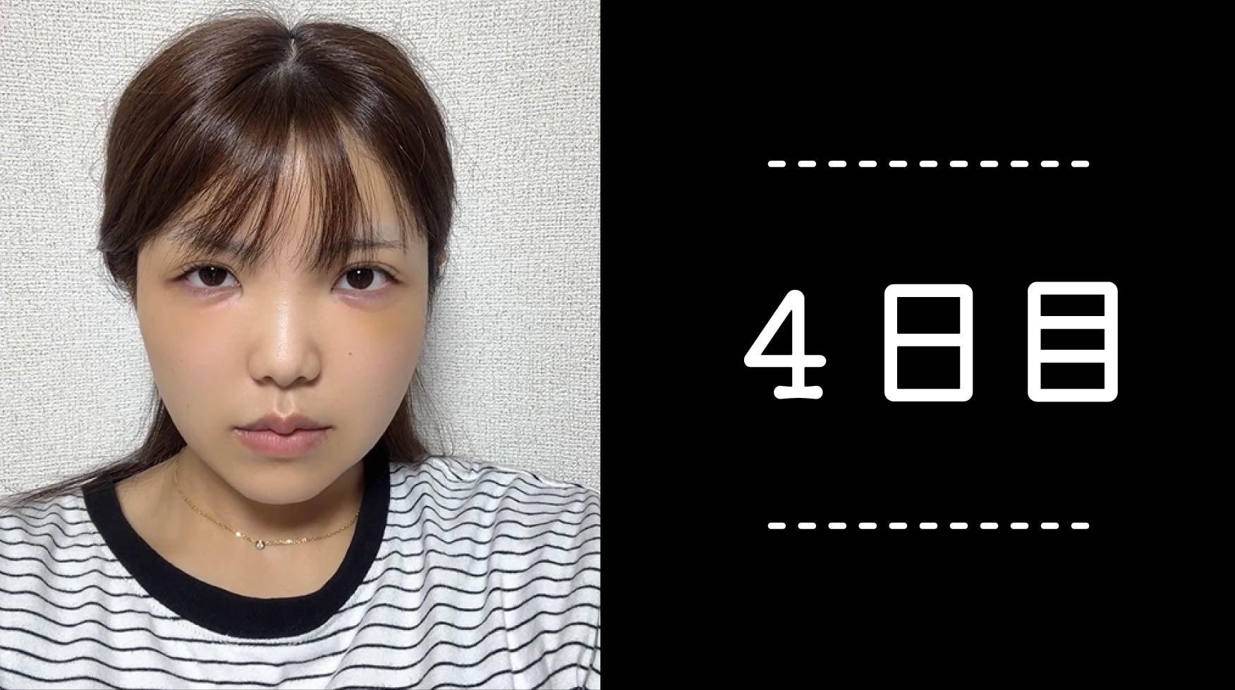 クマ取り30日間レポ