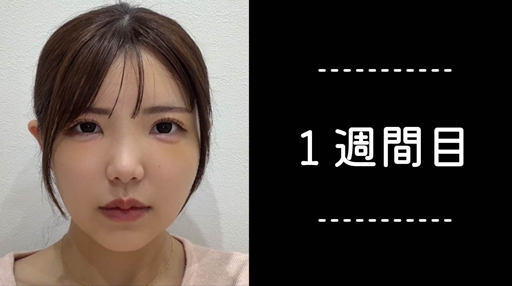 クマ取り30日間レポ