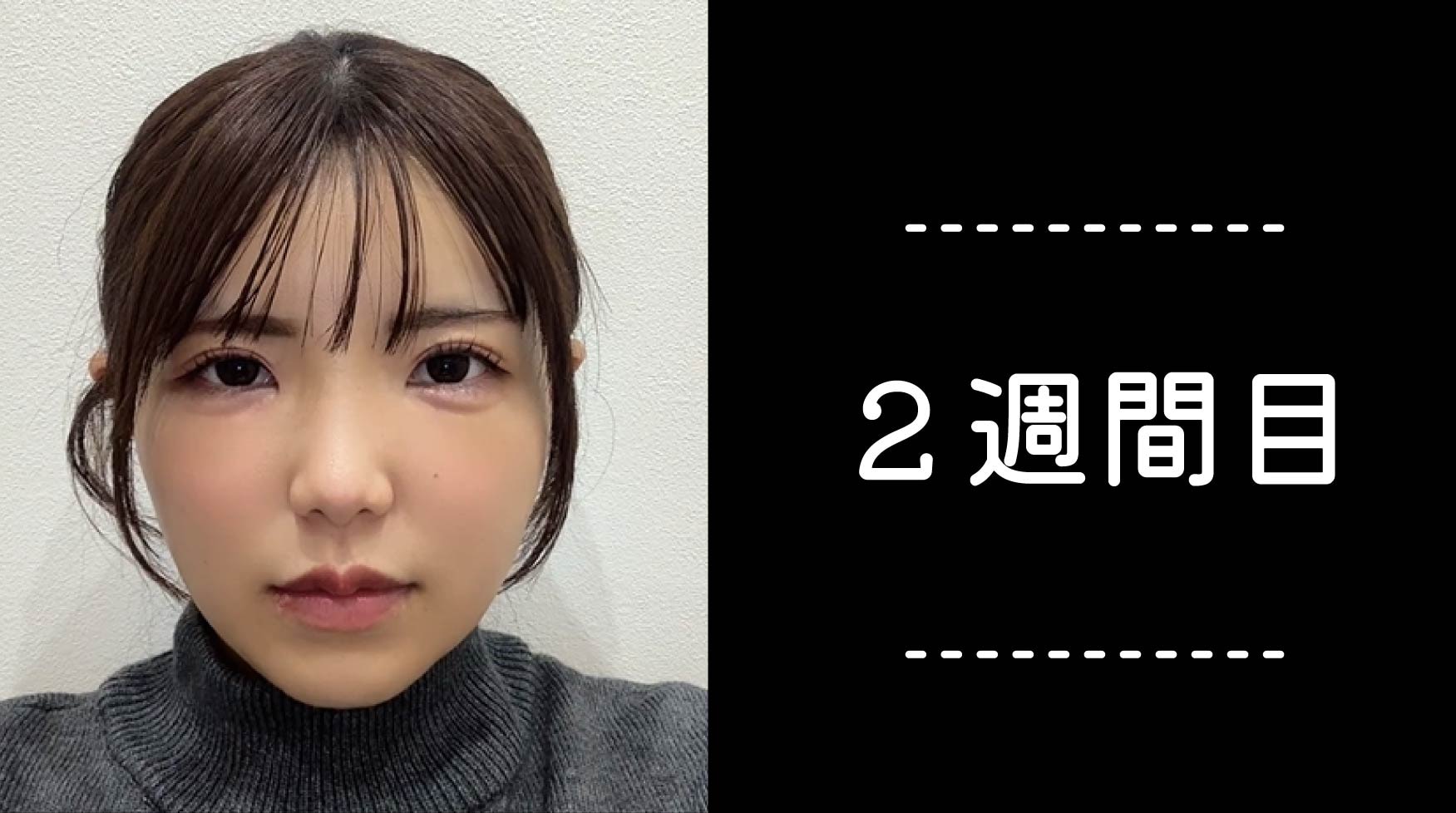 クマ取り30日間レポ