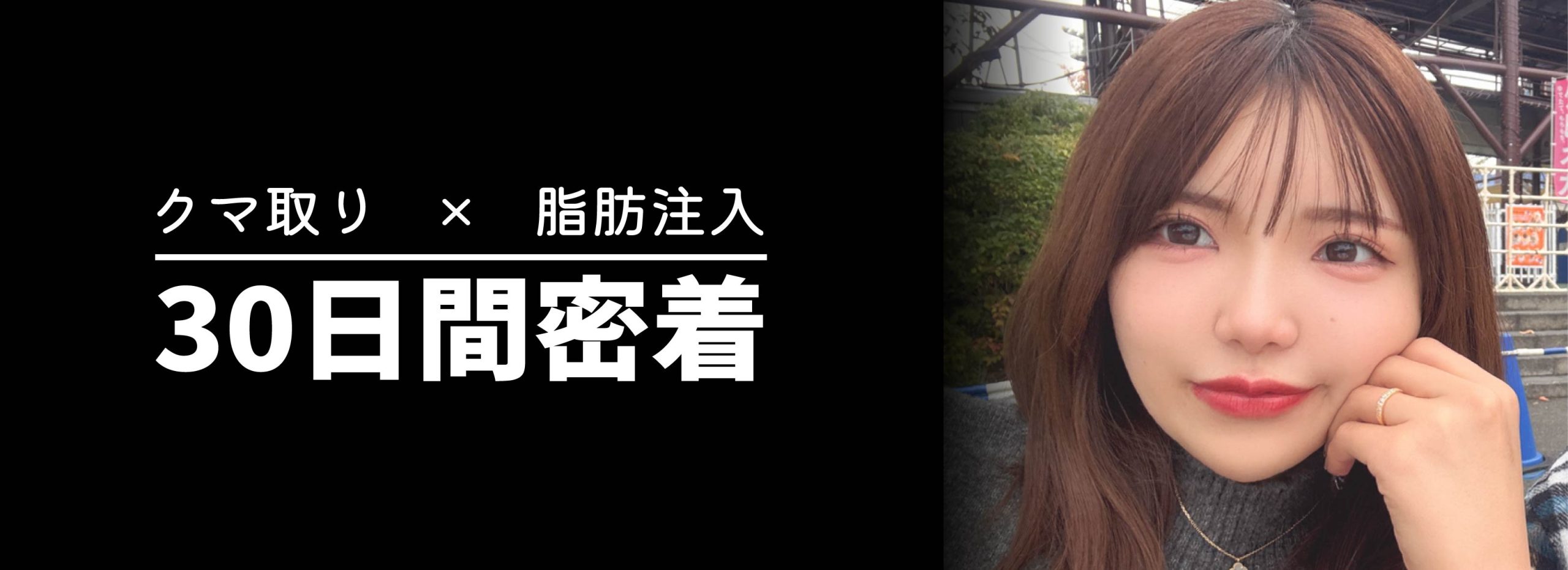 クマ取り30日間レポ