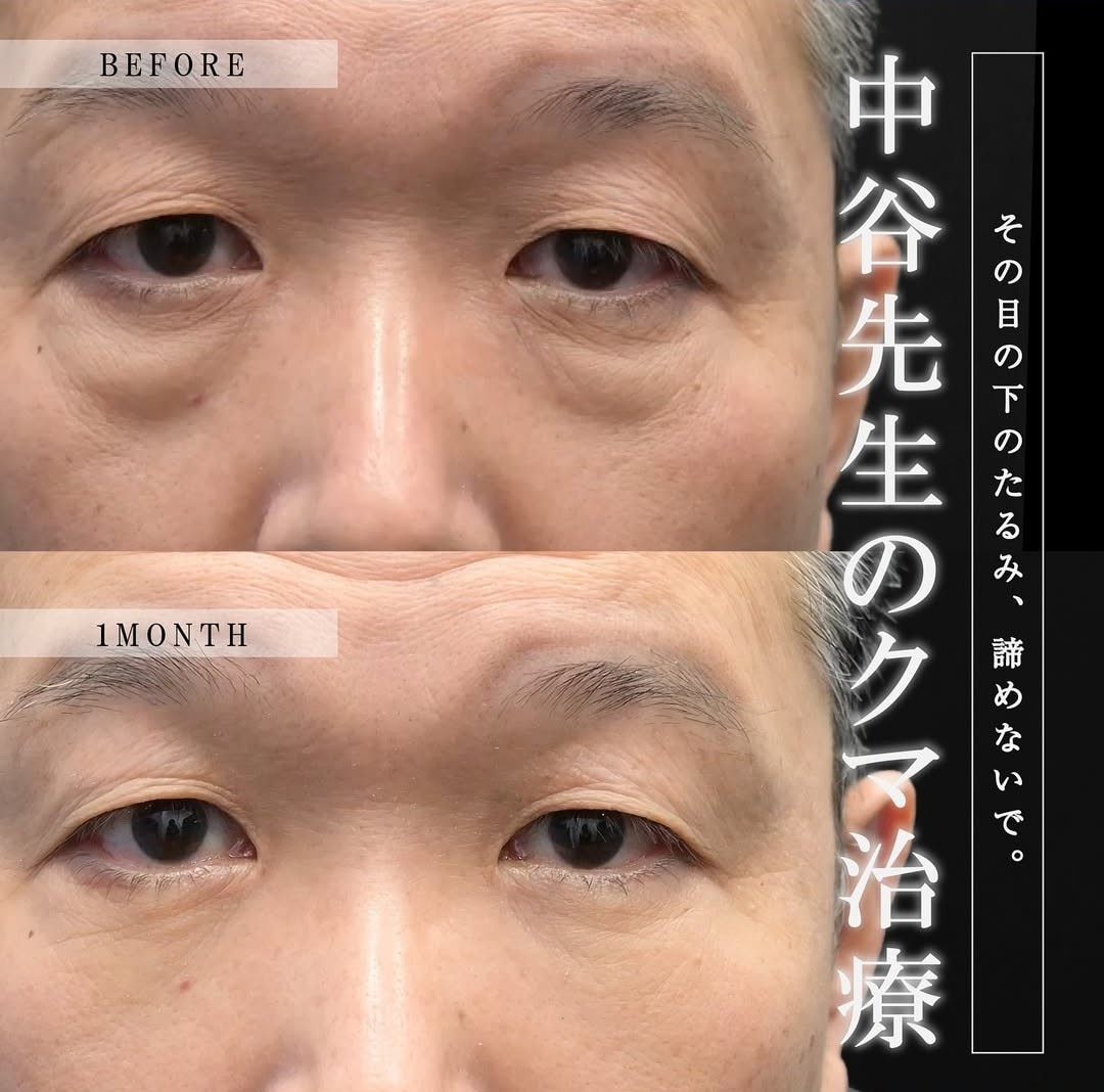 上野院中谷医師のクマの症例