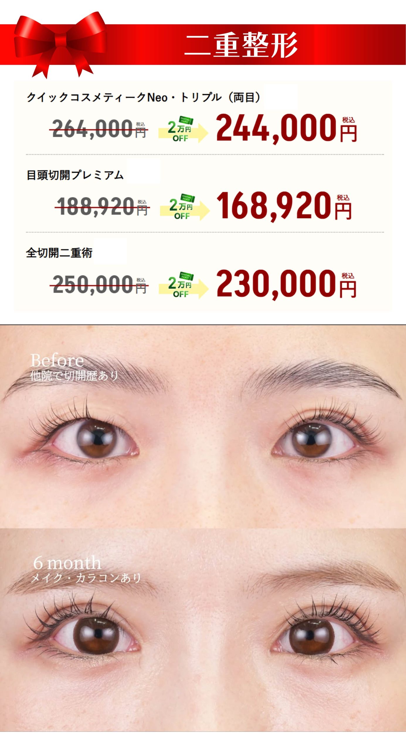 11月のキャンペーン