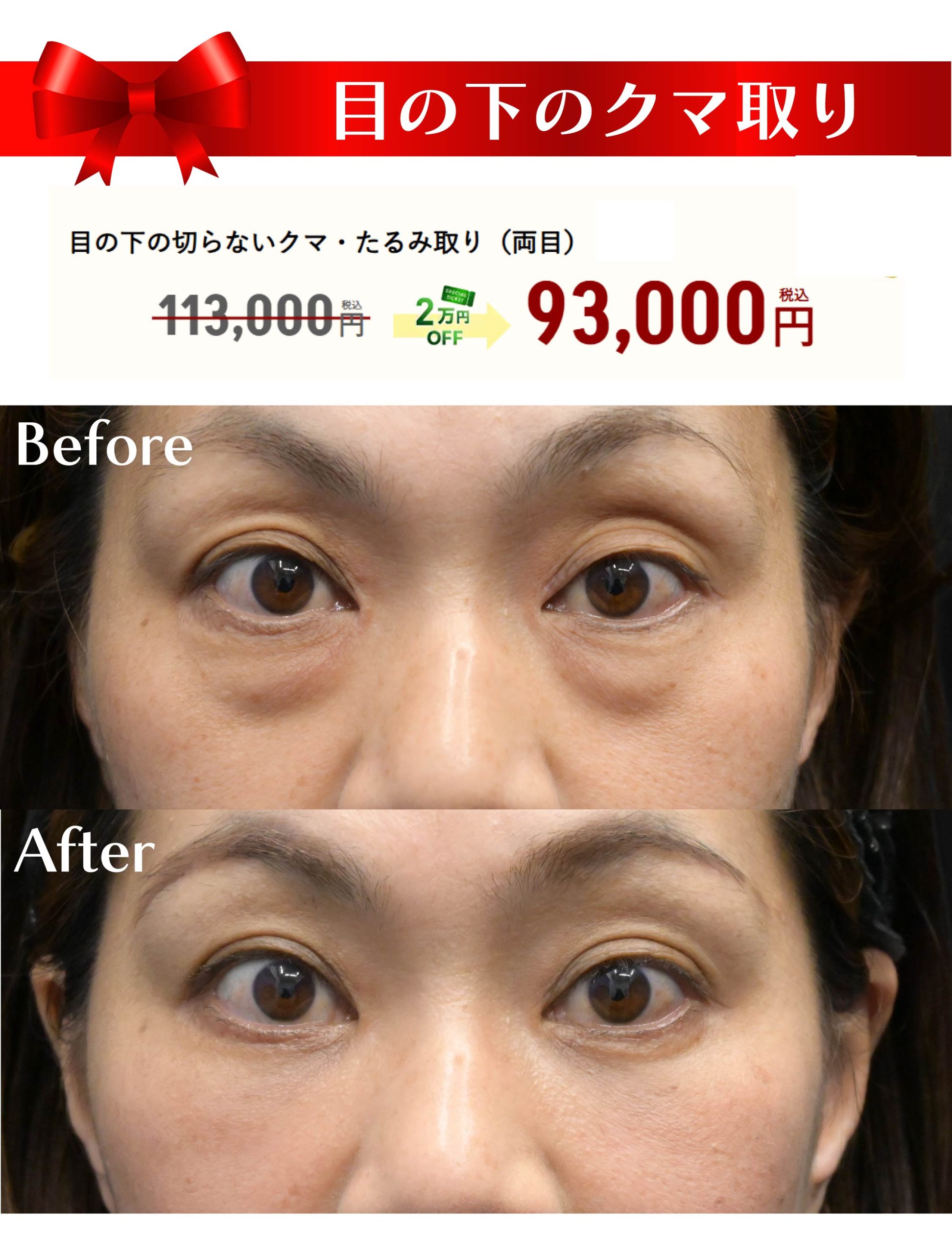 11月のキャンペーン