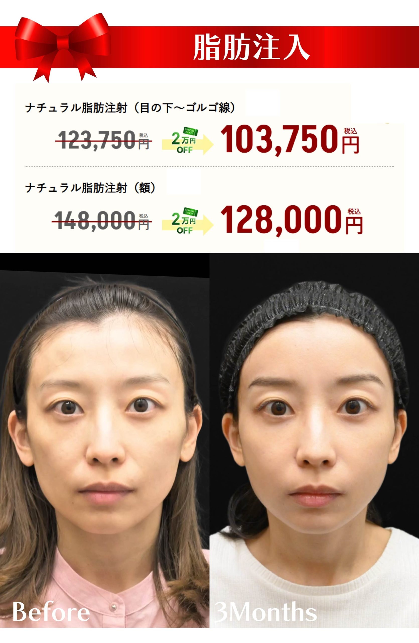 11月のキャンペーン