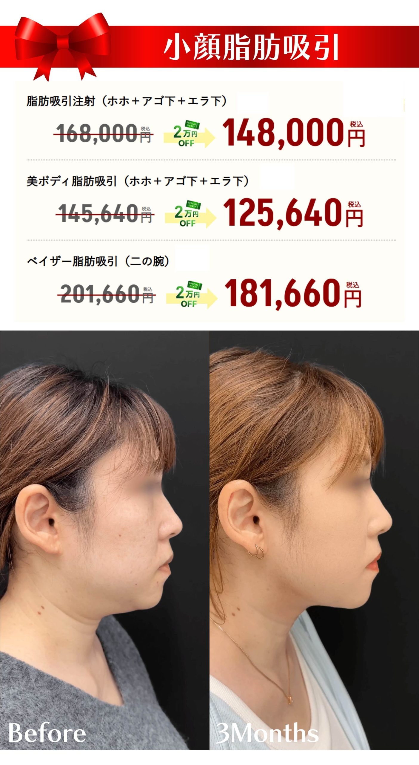 11月のキャンペーン