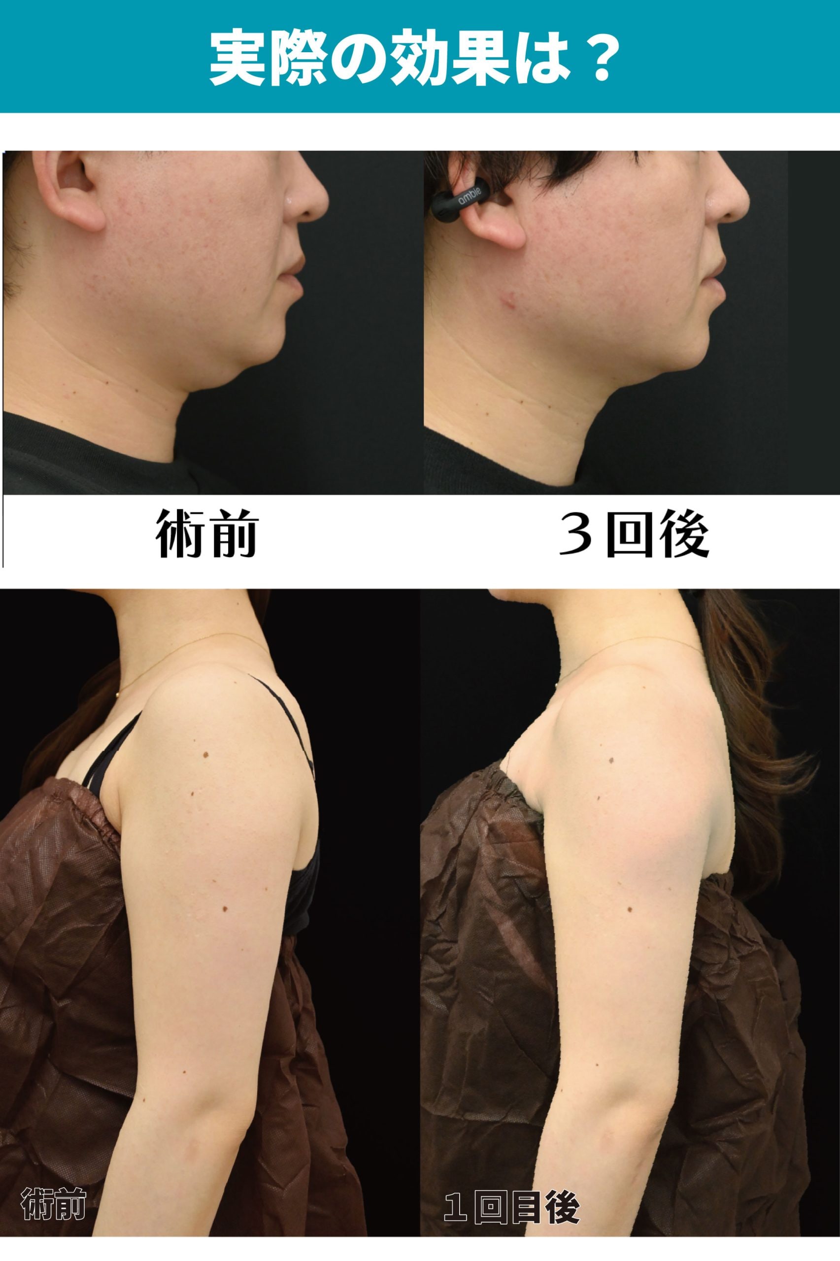 11月のキャンペーン