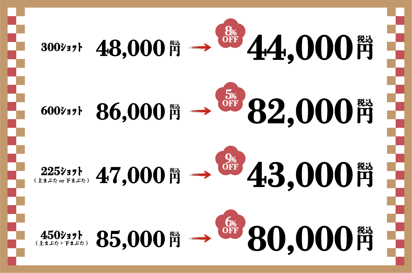 デンシティ価格
