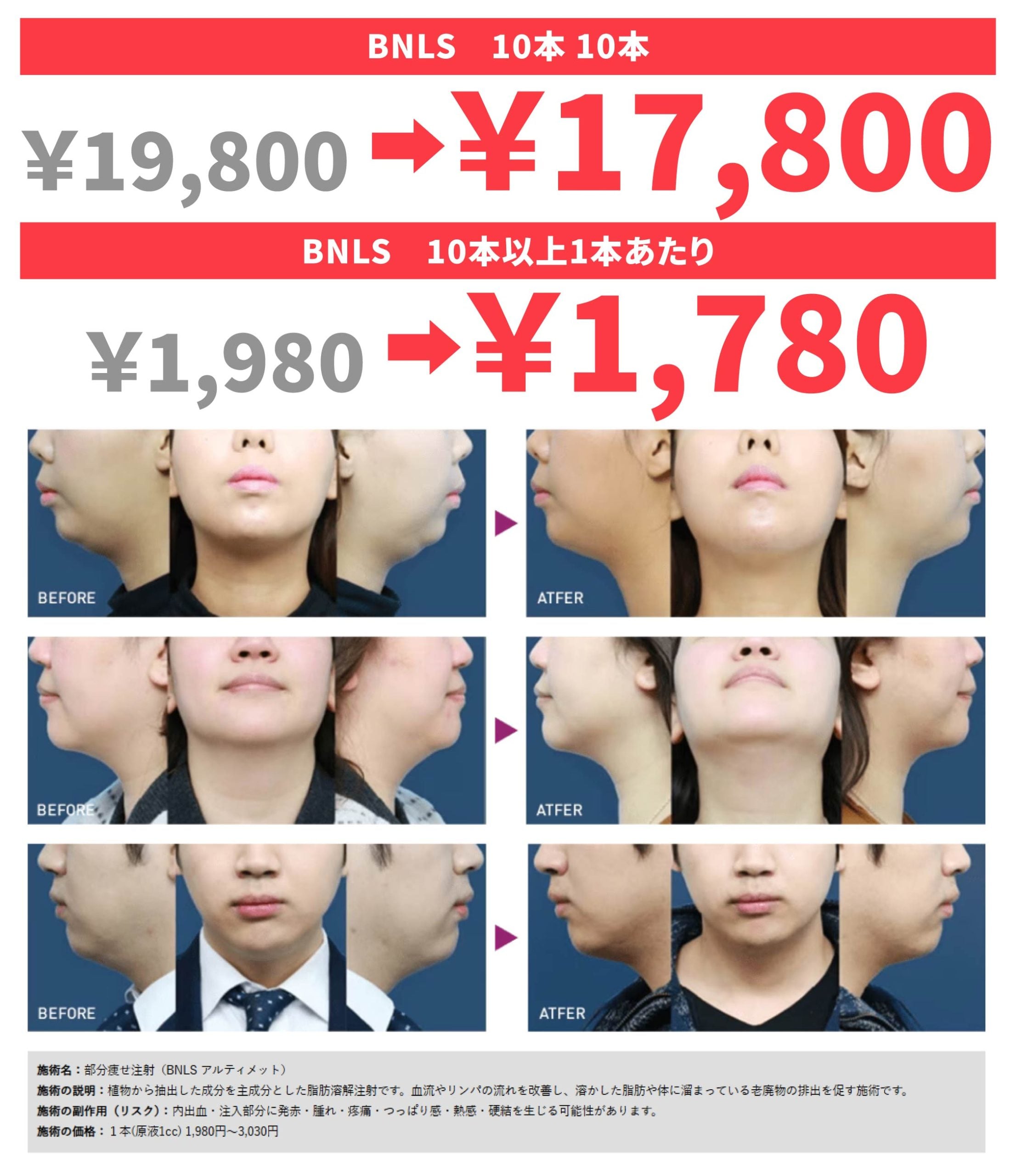 11月のキャンペーン