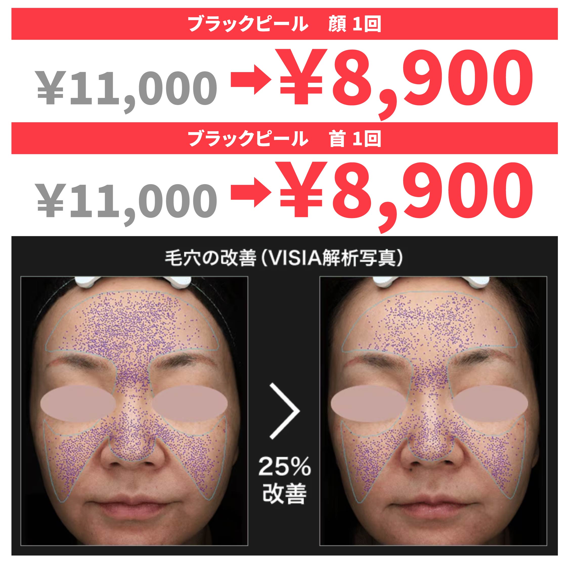 11月のキャンペーン