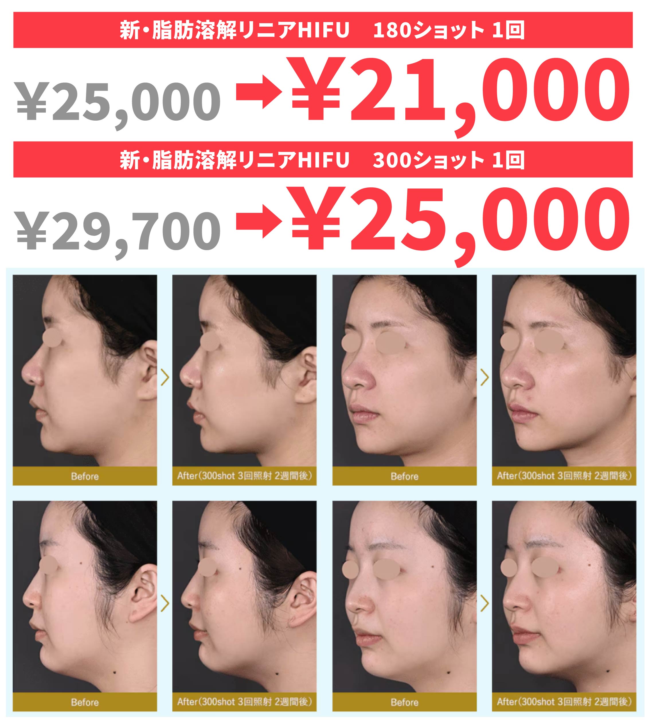 11月のキャンペーン