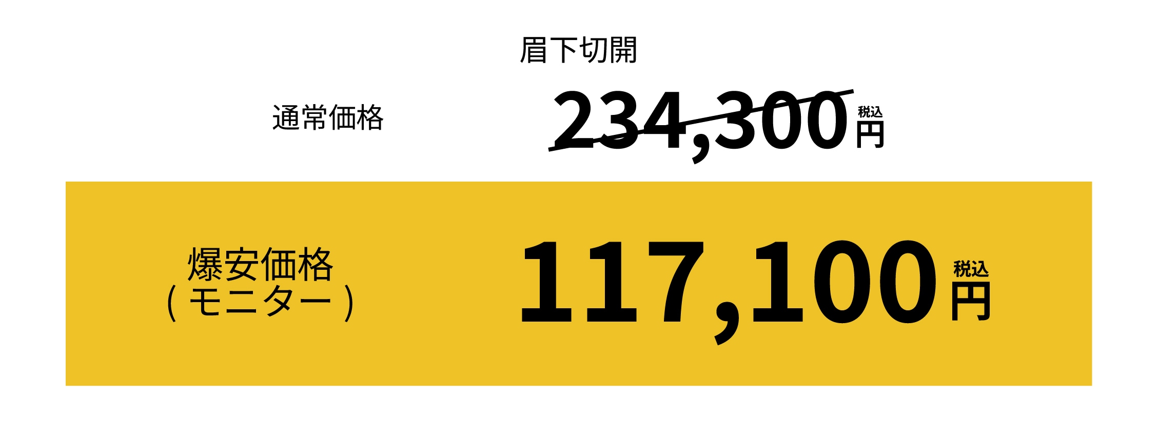 [眉下切開 価格]