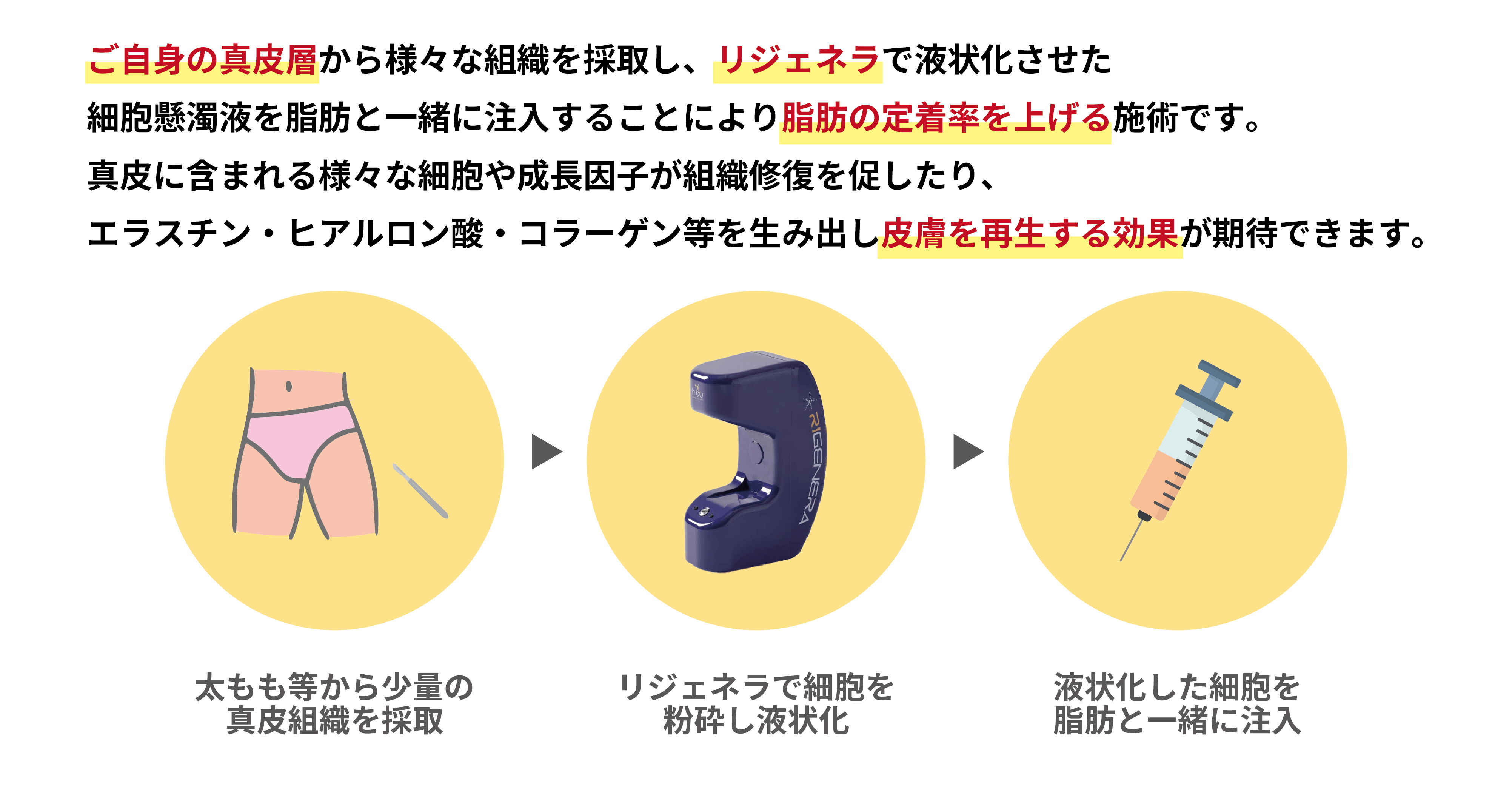 リジェネラとは