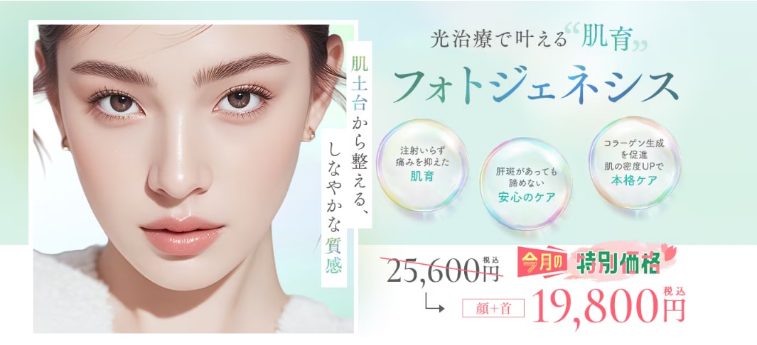 フォトジェネシス