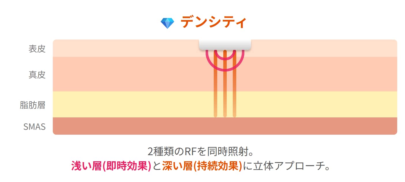 デンシティの照射範囲