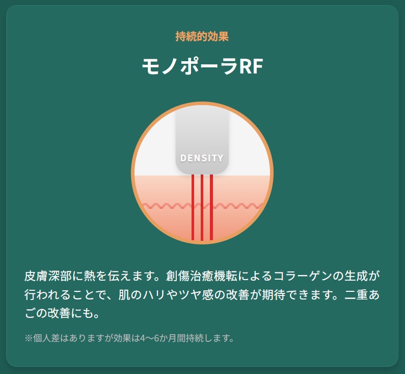 バイポーラ技術解説