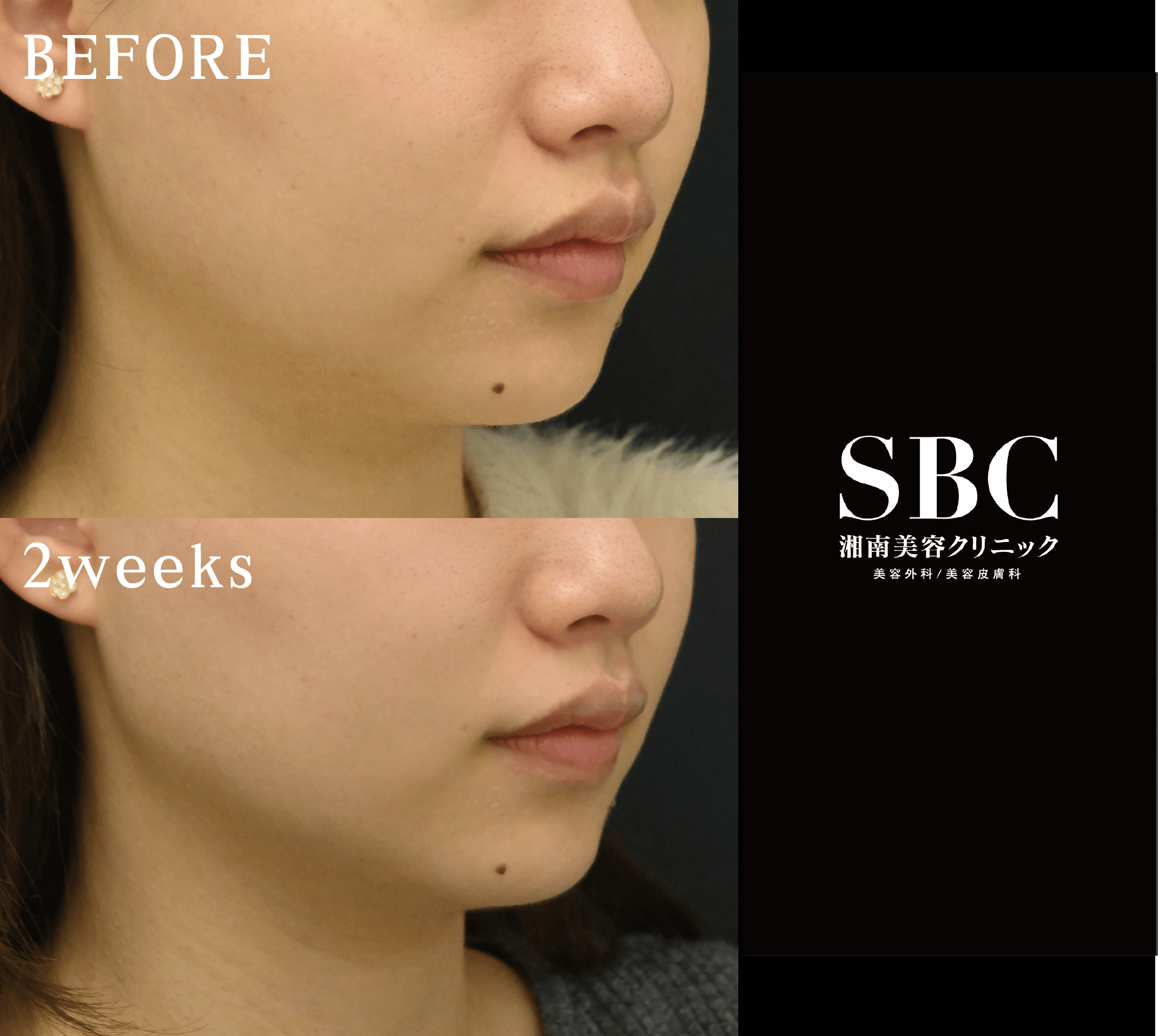 オンダ症例(顔)