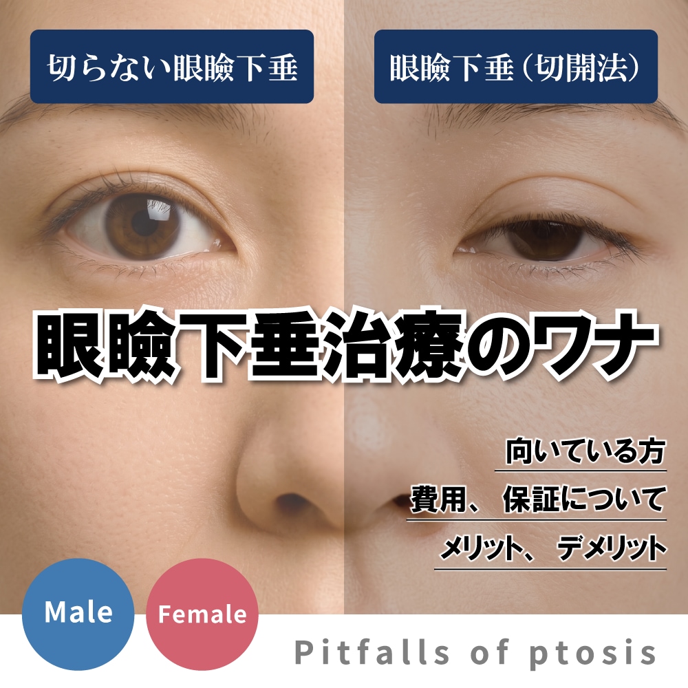 【眼瞼下垂治療のワナ】埋没法や切開法のリスクとは？｜後悔しない「切らない真崎式」