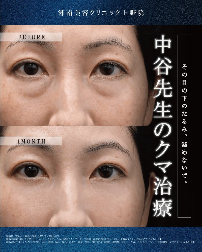 クマ取り症例