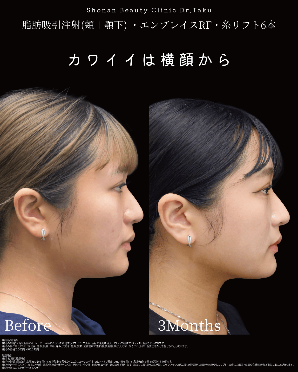 症例写真