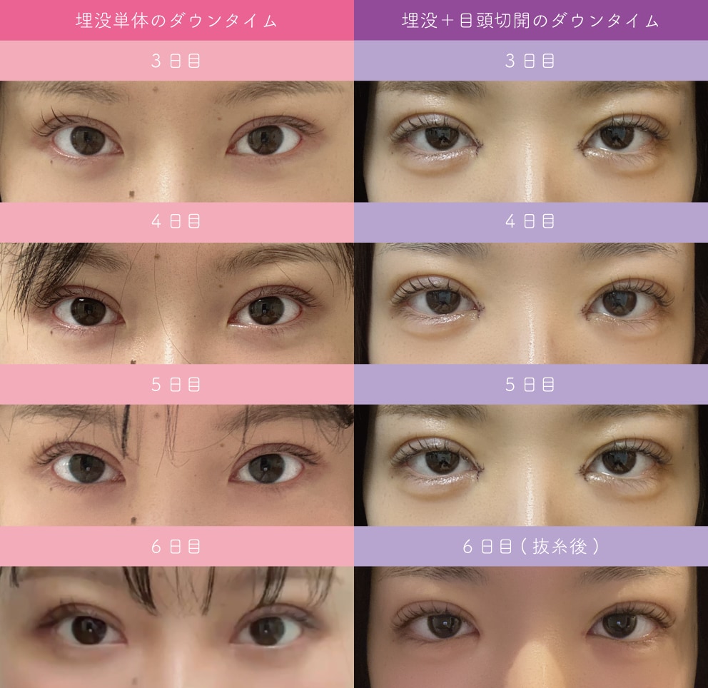 3〜6日比較